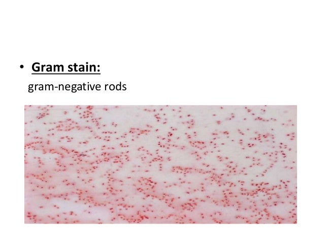 klebsiella spp klebsiella pneumoniae gram stain