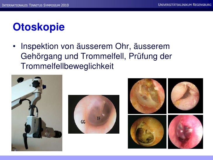 Tinnitus Aus Der Sicht Der HNO Heilkunde Tinnitus Aus Der Sicht Der HNO Heilkunde
