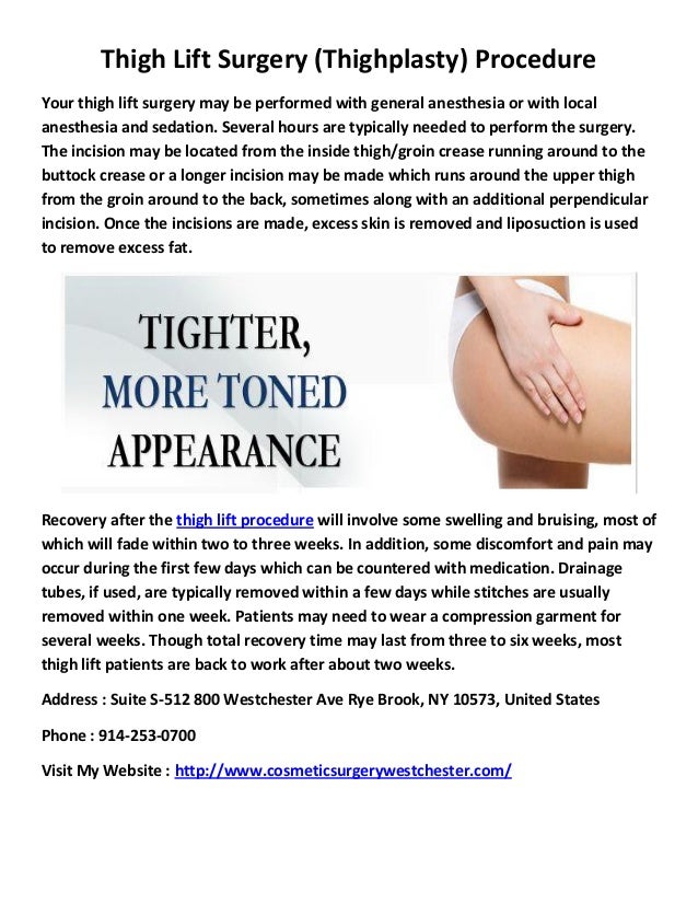 Kleinman plastic surgery thigh lift procedure in new york