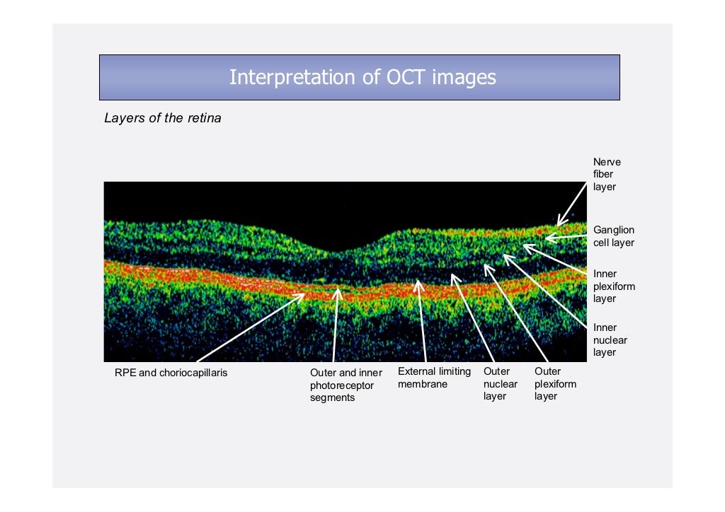 İnterpretation of optic coherence tomography images