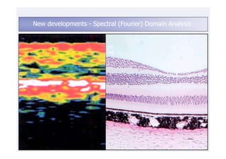 New developments - Spectral (Fourier) Domain Analysis
 