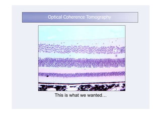 Optical Coherence Tomography




  This is what we wanted…
 