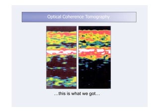 Optical Coherence Tomography




  …this is what we got…
 