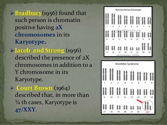 Klinefelter Syndrome