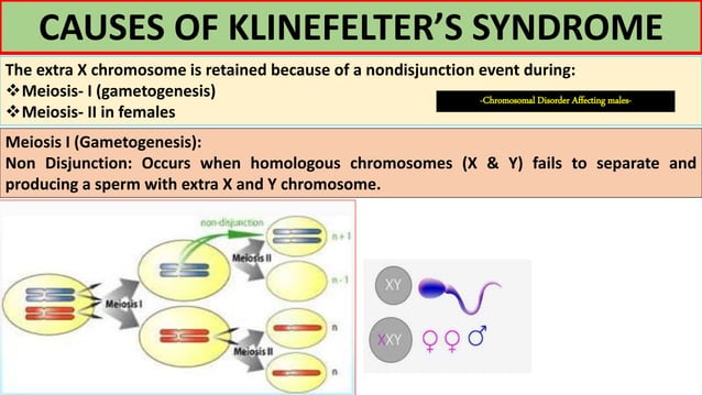 Klinefelter Syndrome PPTX Infertility Reproductive Health klinefelter-syndrome-pptx-infertility-reproductive-health