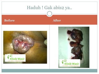 Haduh ! Gak abis2 ya..

Before               After
 