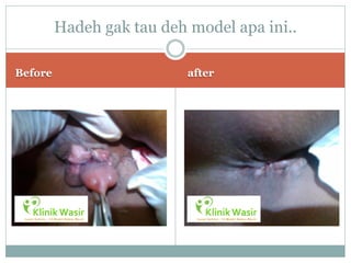 Hadeh gak tau deh model apa ini..

Before                     after
 
