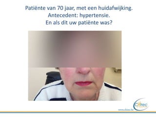 Patiënte van 70 jaar, met een huidafwijking.
Antecedent: hypertensie.
En als dit uw patiënte was?
 