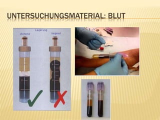 UNTERSUCHUNGSMATERIAL: BLUT
 
