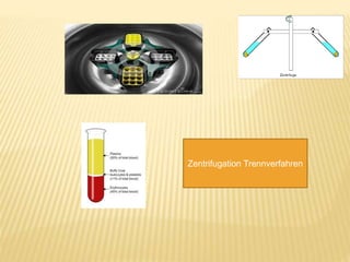 Zentrifugation Trennverfahren
 