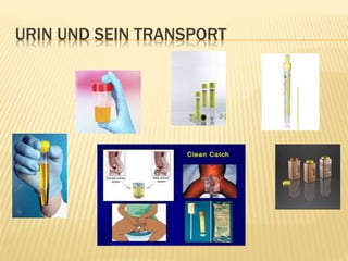 URIN UND SEIN TRANSPORT
 