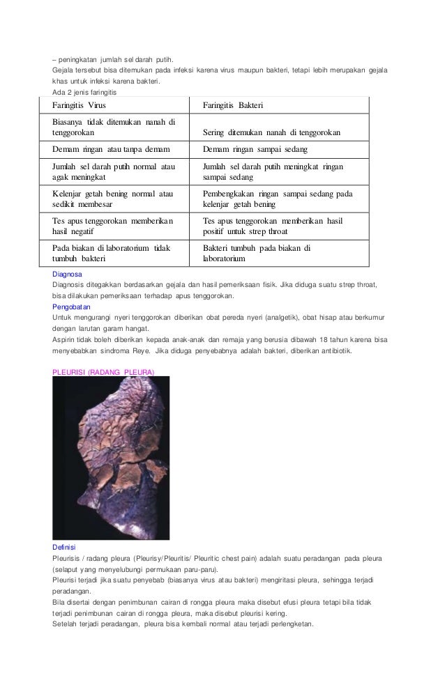 Kliping penyakit sistem pernafasan Kliping penyakit sistem pernafasan