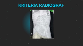 Loopografi Normal Radiologi KLP 1 TR 3 COLON IN LOOP PEDIATRIC.pptx