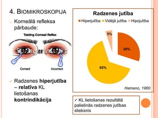 4. BIOMIKROSKOPIJA
o

Korneālā refleksa
pārbaude:

Radzenes jutība
Hiperjutība

Vidējā jutība

Hipojutība

5%

30%

65%



Radzenes hiperjutība
– relatīva KL
lietošanas
kontrindikācija

Hamano, 1960
 KL lietošanas rezultātā

palielinās radzenes jutības
slieksnis

 
