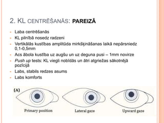2. KL CENTRĒŠANĀS: PAREIZĀ










Laba centrēšanās
KL pilnībā nosedz radzeni
Vertikālās kustības amplitūda mirkšķināšanas laikā nepārsniedz
0,1-0,5mm
Acs ābola kustība uz augšu un uz deguna pusi – 1mm novirze
Push up tests: KL viegli nobīdās un ātri atgriežas sākotnējā
pozīcijā
Labs, stabils redzes asums
Labs komforts

 