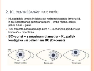 2. KL CENTRĒŠANĀS: PAR CIEŠU






KL sagitālais izmērs ir lielāks par radzenes sagitālo izmēru: KL
ir divi saskaršanās punkti ar radzeni – limba rajonā, centrs
paliek tukšs – gaiss
Tiek traucēta asaru apmaiņa zem KL, mehānisks spiediens uz
limba a/v – hiperēmija

BC=const + samazinam diametru = KL paliek
kustīgāka vai palielinam BC (D=const)

 