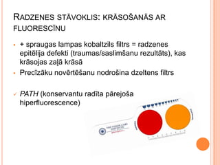 RADZENES STĀVOKLIS: KRĀSOŠANĀS AR
FLUORESCĪNU






+ spraugas lampas kobaltzils filtrs = radzenes
epitēlija defekti (traumas/saslimšanu rezultāts), kas
krāsojas zaļā krāsā
Precīzāku novērtēšanu nodrošina dzeltens filtrs

PATH (konservantu radīta pārejoša
hiperfluorescence)

 