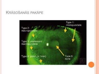 KRĀSOŠANĀS PAKĀPE

 