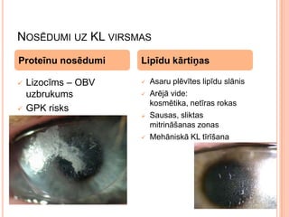 NOSĒDUMI UZ KL VIRSMAS
Proteīnu nosēdumi




Lizocīms – OBV
uzbrukums
GPK risks

Lipīdu kārtiņas







Asaru plēvītes lipīdu slānis
Arējā vide:
kosmētika, netīras rokas
Sausas, sliktas
mitrināšanas zonas
Mehāniskā KL tīrīšana

 