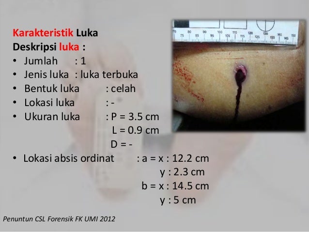 Image Result For Jenis Jenis Perjudian Image Result For Jenis Jenis Perjudian