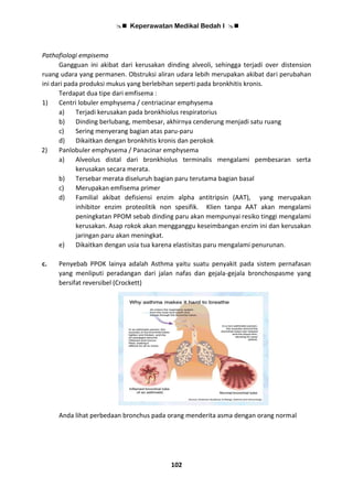 Keperawatan Medikal Bedah I 
102
Pathofiologi empisema
Gangguan ini akibat dari kerusakan dinding alveoli, sehingga terjadi over distension
ruang udara yang permanen. Obstruksi aliran udara lebih merupakan akibat dari perubahan
ini dari pada produksi mukus yang berlebihan seperti pada bronkhitis kronis.
Terdapat dua tipe dari emfisema :
1) Centri lobuler emphysema / centriacinar emphysema
a) Terjadi kerusakan pada bronkhiolus respiratorius
b) Dinding berlubang, membesar, akhirnya cenderung menjadi satu ruang
c) Sering menyerang bagian atas paru-paru
d) Dikaitkan dengan bronkhitis kronis dan perokok
2) Panlobuler emphysema / Panacinar emphysema
a) Alveolus distal dari bronkhiolus terminalis mengalami pembesaran serta
kerusakan secara merata.
b) Tersebar merata diseluruh bagian paru terutama bagian basal
c) Merupakan emfisema primer
d) Familial akibat defisiensi enzim alpha antitripsin (AAT), yang merupakan
inhibitor enzim proteolitik non spesifik. Klien tanpa AAT akan mengalami
peningkatan PPOM sebab dinding paru akan mempunyai resiko tinggi mengalami
kerusakan. Asap rokok akan mengganggu keseimbangan enzim ini dan kerusakan
jaringan paru akan meningkat.
e) Dikaitkan dengan usia tua karena elastisitas paru mengalami penurunan.
c. Penyebab PPOK lainya adalah Asthma yaitu suatu penyakit pada sistem pernafasan
yang menliputi peradangan dari jalan nafas dan gejala-gejala bronchospasme yang
bersifat reversibel (Crockett)
Anda lihat perbedaan bronchus pada orang menderita asma dengan orang normal
 