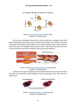  Keperawatan Medikal Bedah I 
4
Sumber, http://Slideshare.com, diunduh 2016.
Gambar 1.1 Stroke Volume
b) arteri besar kehilangan kelenturannya maka menjadi kaku, sehingga mereka tidak
dapat mengembang pada saat jantung memompa darah melalui arteri tersebut, karenanya
darah pada setiap denyut jantung dipaksa untuk melalui pembuluh darah yang sempit dari
pada biasanya dan menyebabkan naiknya tekanan darah. Inilah yang terjadi pada usia lanjut,
di mana dinding arterinya telah menebal dan kaku karena arteriosklerosis.
Sumber : http:// http://strokelumpuh.com, diunduh 2016
Gambar 1.2 Arteriosklerosis
c) tekanan darah juga meningkat pada saat terjadi vasokonstriksi, yaitu jika arteri kecil
(arteriola) untuk sementara waktu mengkerut karena perangsangan saraf atau hormon di
dalam darah.
Sumber : http://Internetdict.com, diunduh 2016
Gambar 1.3 Vasokonstriksi
 