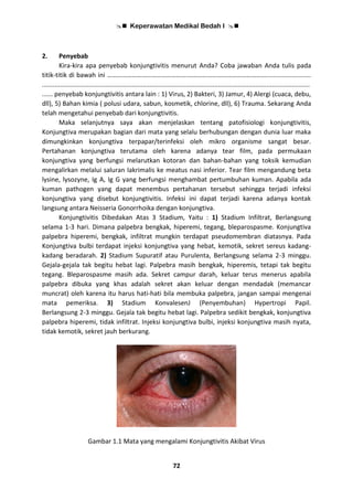  Keperawatan Medikal Bedah I 
72
2. Penyebab
Kira-kira apa penyebab konjungtivitis menurut Anda? Coba jawaban Anda tulis pada
titik-titik di bawah ini ………………………………………….………………………………………….........................
.....................................................................................................................................................
...... penyebab konjungtivitis antara lain : 1) Virus, 2) Bakteri, 3) Jamur, 4) Alergi (cuaca, debu,
dll), 5) Bahan kimia ( polusi udara, sabun, kosmetik, chlorine, dll), 6) Trauma. Sekarang Anda
telah mengetahui penyebab dari konjungtivitis.
Maka selanjutnya saya akan menjelaskan tentang patofisiologi konjungtivitis,
Konjungtiva merupakan bagian dari mata yang selalu berhubungan dengan dunia luar maka
dimungkinkan konjungtiva terpapar/terinfeksi oleh mikro organisme sangat besar.
Pertahanan konjungtiva terutama oleh karena adanya tear film, pada permukaan
konjungtiva yang berfungsi melarutkan kotoran dan bahan-bahan yang toksik kemudian
mengalirkan melalui saluran lakrimalis ke meatus nasi inferior. Tear film mengandung beta
lysine, lysozyne, Ig A, Ig G yang berfungsi menghambat pertumbuhan kuman. Apabila ada
kuman pathogen yang dapat menembus pertahanan tersebut sehingga terjadi infeksi
konjungtiva yang disebut konjungtivitis. Infeksi ini dapat terjadi karena adanya kontak
langsung antara Neisseria Gonorrhoika dengan konjungtiva.
Konjungtivitis Dibedakan Atas 3 Stadium, Yaitu : 1) Stadium Infiltrat, Berlangsung
selama 1-3 hari. Dimana palpebra bengkak, hiperemi, tegang, bleparospasme. Konjungtiva
palpebra hiperemi, bengkak, infiltrat mungkin terdapat pseudomembran diatasnya. Pada
Konjungtiva bulbi terdapat injeksi konjungtiva yang hebat, kemotik, sekret sereus kadang-
kadang beradarah. 2) Stadium Supuratif atau Purulenta, Berlangsung selama 2-3 minggu.
Gejala-gejala tak begitu hebat lagi. Palpebra masih bengkak, hiperemis, tetapi tak begitu
tegang. Bleparospasme masih ada. Sekret campur darah, keluar terus menerus apabila
palpebra dibuka yang khas adalah sekret akan keluar dengan mendadak (memancar
muncrat) oleh karena itu harus hati-hati bila membuka palpebra, jangan sampai mengenai
mata pemeriksa. 3) Stadium KonvalesenJ (Penyembuhan) Hypertropi Papil.
Berlangsung 2-3 minggu. Gejala tak begitu hebat lagi. Palpebra sedikit bengkak, konjungtiva
palpebra hiperemi, tidak infiltrat. Injeksi konjungtiva bulbi, injeksi konjungtiva masih nyata,
tidak kemotik, sekret jauh berkurang.
Gambar 1.1 Mata yang mengalami Konjungtivitis Akibat Virus
 