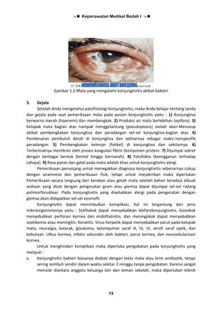  Keperawatan Medikal Bedah I 
73
Gambar 1.2 Mata yang mengalami konjungtivitis akibat bakteri
3. Gejala
Setelah Anda mengetahui patofisiologi konjungtivitis, maka Anda belajar tentang tanda
dan gejala pada saat pemeriksaan mata pada pasien konjungtivitis yaitu : 1) Konjungtiva
berwarna merah (hiperemi) dan membengkak. 2) Produksi air mata berlebihan (epifora). 3)
Kelopak mata bagian atas nampak menggelantung (pseudoptosis) seolah akan Menutup
akibat pembengkakan konjungtiva dan peradangan sel-sel konjungtiva bagian atas. 4)
Pembesaran pembuluh darah di konjungtiva dan sekitarnya sebagai reaksi nonspesifik
peradangan. 5) Pembengkakan kelenjar (folikel) di konjungtiva dan sekitarnya. 6)
Terbentuknya membran oleh proses koagulasi fibrin (komponen protein. 7) Dijumpai sekret
dengan berbagai bentuk (kental hingga bernanah). 8) Fotofobia (keengganan terhadap
cahaya). 9) Rasa panas dan gatal pada mata adalah khas untuk konjungtivitis alergi
Pemeriksaan penunjang untuk menegakkan diagnosa konjungtivitis sebenarnya cukup
dengan anamnese dan pemeriksaan fisik, tetapi untuk meyakinkan maka diperlukan
Pemeriksaan secara langsung dari kerokan atau getah mata setelah bahan tersebut dibuat
sediaan yang dicat dengan pengecatan gram atau giemsa dapat dijumpai sel-sel radang
polimorfonuklear. Pada konjungtivitis yang disebabkan alergi pada pengecatan dengan
giemsa akan didapatkan sel-sel eosinofil.
Konjungtivitis dapat menimbulkan komplikasi, hal ini tergantung dari jenis
mikroorganismenya yaitu : Stafilokok dapat menyebabkan blefarokonjungtivitis, Gonokok
menyebabkan perforasi kornea dan endoftalmitis, dan meningokok dapat menyebabkan
septikemia atau meningitis. Keratitis. Virus herpetik dapat menyebabkan parut pada kelopak
mata, neuralgia, katarak, glaukoma, kelumpuhan saraf III, IV, VI, atrofi saraf optik, dan
kebutaan. Ulkus kornea, infeksi sekunder oleh bakteri, parut kornea, dan neovaskularisasi
kornea.
Untuk menghindari komplikasi maka diperluka pengobatan pada konjungtivitis yang
meliputi :
a. Konjungtivitis bakteri biasanya diobati dengan tetes mata atau krim antibiotik, tetapi
sering sembuh sendiri dalam waktu sekitar 2 minggu tanpa pengobatan. Karena sangat
menular diantara anggota keluarga lain dan teman sekolah, maka diperlukan teknik
 