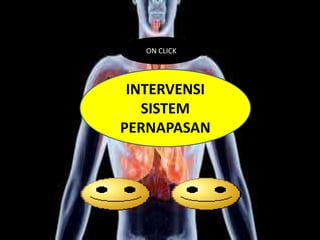 ON CLICK

INTERVENSI
SISTEM
PERNAPASAN

 
