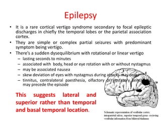 Epilepsy
• It is a rare cortical vertigo syndrome secondary to focal epileptic
discharges in chiefly the temporal lobes or the parietal association
cortex.
• They are simple or complex partial seizures with predominant
symptom being vertigo.
• There’s a sudden dysequilibrium with rotational or linear vertigo
– lasting seconds to minutes
– associated with body, head or eye rotation with or without nystagmus
– may be associated nausea
– skew deviation of eyes with nystagmus during attacks may occur
– tinnitus, contralateral paesthesia, olfactory or gustatory sensations
may precede the episode
This suggests lateral and
superior rather than temporal
and basal temporal location.
 