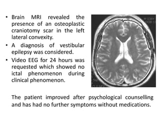 • Brain MRI revealed the
presence of an osteoplastic
craniotomy scar in the left
lateral convexity.
• A diagnosis of vestibular
epilepsy was considered.
• Video EEG for 24 hours was
requested which showed no
ictal phenomenon during
clinical phenomenon.
The patient improved after psychological counselling
and has had no further symptoms without medications.
 