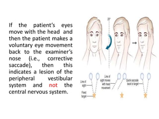 If the patient’s eyes
move with the head and
then the patient makes a
voluntary eye movement
back to the examiner’s
nose (i.e., corrective
saccade), then this
indicates a lesion of the
peripheral vestibular
system and not the
central nervous system.
 