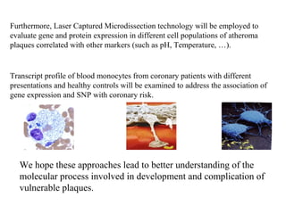 Transcript profile of blood monocytes from coronary patients with different
presentations and healthy controls will be examined to address the association of
gene expression and SNP with coronary risk.
Furthermore, Laser Captured Microdissection technology will be employed to
evaluate gene and protein expression in different cell populations of atheroma
plaques correlated with other markers (such as pH, Temperature, …).
We hope these approaches lead to better understanding of the
molecular process involved in development and complication of
vulnerable plaques.
 