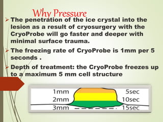 Why Pressure
 The penetration of the ice crystal into the
lesion as a result of cryosurgery with the
CryoProbe will go faster and deeper with
minimal surface trauma.
 The freezing rate of CryoProbe is 1mm per 5
seconds .
 Depth of treatment: the CryoProbe freezes up
to a maximum 5 mm cell structure
 