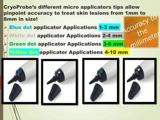 CryoProbe’s different micro applicators tips allow
pinpoint accuracy to treat skin lesions from 1mm to
8mm in size!
 Blue dot applicator Applications 1-3 mm
 White dot applicator Applications 2-4 mm
 Green dot applicator Applications 3-6 mm
 Yellow dot applicator Applications 4-10 mm
 