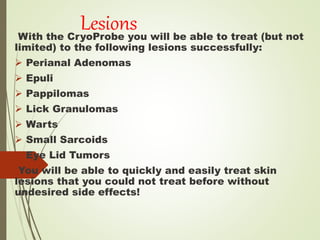 Lesions
With the CryoProbe you will be able to treat (but not
limited) to the following lesions successfully:
 Perianal Adenomas
 Epuli
 Pappilomas
 Lick Granulomas
 Warts
 Small Sarcoids
 Eye Lid Tumors
You will be able to quickly and easily treat skin
lesions that you could not treat before without
undesired side effects!
 