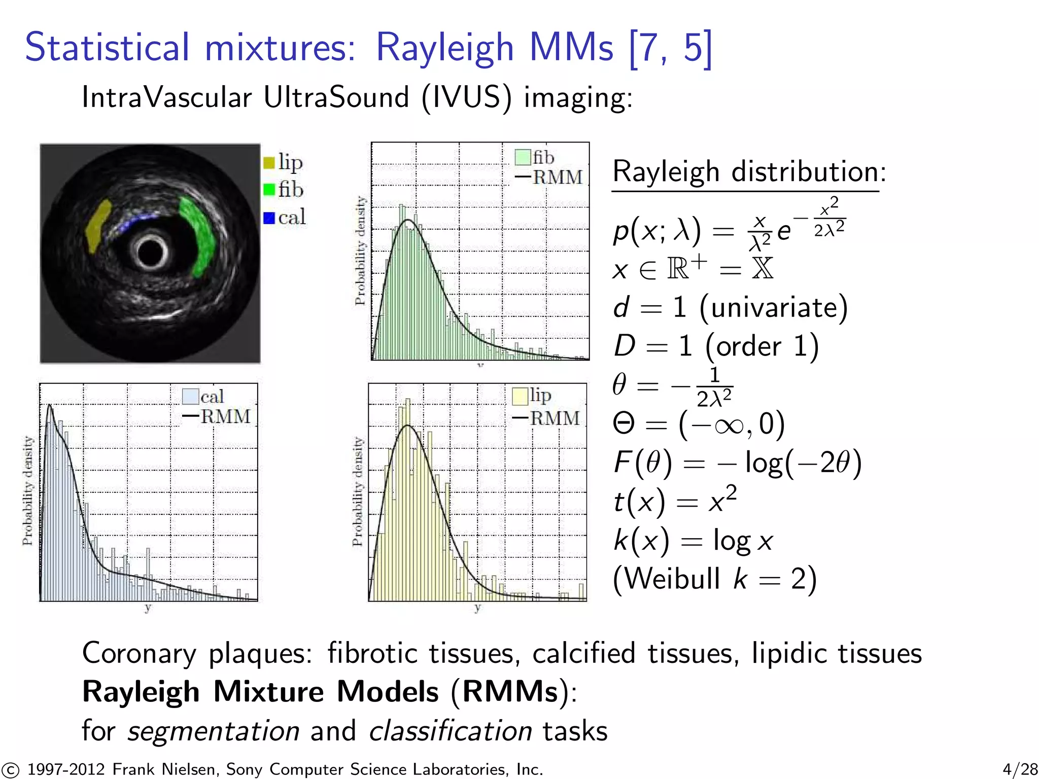 Statistical mixtures: Rayleigh MMs [7, 5] 
IntraVascular UltraSound (IVUS) imaging: 
Rayleigh distribution: 
p(x; ) = x 
2 e− x2 
22 
x 2 R+ = X 
d = 1 (univariate) 
D = 1 (order 1) 
 = − 1 
22 
 = (−1, 0) 
F() = −log(−2) 
t(x) = x2 
k(x) = log x 
(Weibull k = 2) 
Coronary plaques: fibrotic tissues, calcified tissues, lipidic tissues 
Rayleigh Mixture Models (RMMs): 
for segmentation and classification tasks 

c 1997-2012 Frank Nielsen, Sony Computer Science Laboratories, Inc. 4/28 
 