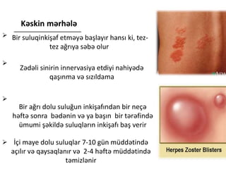 Kəskin mərhələ
Bir suluqinkişaf etməyə başlayır hansı ki, tez-
tez ağrıya səbə olur
Zədəli sinirin innervasiya etdiyi nahiyədə
qaşınma və sızıldama
Bir ağrı dolu suluğun inkişafından bir neçə
həftə sonra bədənin və ya başın bir tərəfində
ümumi şəkildə suluqların inkişafı baş verir
İçi maye dolu suluqlar 7-10 gün müddətində
açılır və qaysaqlanır və 2-4 həftə müddətində
təmizlənir
 