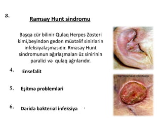 Ramsay Hunt sindromu
Başqa cür bilinir Qulaq Herpes Zosteri
kimi,beyindən gedən müxtəlif sinirlərin
infeksiyalaşmasıdır. Rmasay Hunt
sindromunun ağırlaşmaları üz sinirinin
paralici və qulaq ağrılarıdır.
Ensefalit
Eşitmə problemləri
Dəridə bakterial infeksiya
 