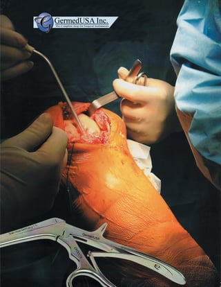 Knee Surgical Instruments catalog