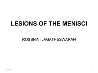 LESIONS OF THE MENISCI
ROSSHINI JAGATHESWARAN
6/3/2014 1
 