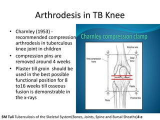 Arthrodesis in TB Knee
• Charnley (1953) -
recommended compression
arthrodesis in tuberculous
knee joint in children
• compression pins are
removed around 4 weeks
• Plaster till groin should be
used in the best possible
functional position for 8
to16 weeks till osseous
fusion is demonstrable in
the x-rays
SM Tuli Tuberculosis of the Skeletal System(Bones, Joints, Spine and Bursal Sheaths)4 e
 