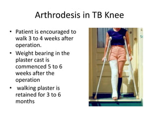 Arthrodesis in TB Knee
• Patient is encouraged to
walk 3 to 4 weeks after
operation.
• Weight bearing in the
plaster cast is
commenced 5 to 6
weeks after the
operation
• walking plaster is
retained for 3 to 6
months
 