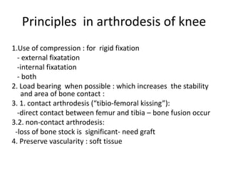 Principles in arthrodesis of knee
1.Use of compression : for rigid fixation
- external fixatation
-internal fixatation
- both
2. Load bearing when possible : which increases the stability
and area of bone contact :
3. 1. contact arthrodesis (“tibio-femoral kissing”):
-direct contact between femur and tibia – bone fusion occur
3.2. non-contact arthrodesis:
-loss of bone stock is significant- need graft
4. Preserve vascularity : soft tissue
 