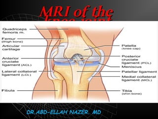 MRI OF THE KNEE JOINT.
Dr/ ABD ALLAH NAZEER. MD.
 