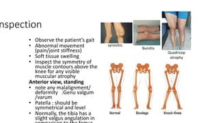 knee.pptx