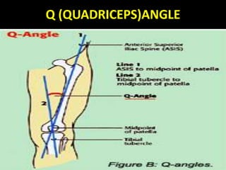 Q (QUADRICEPS)ANGLE
 