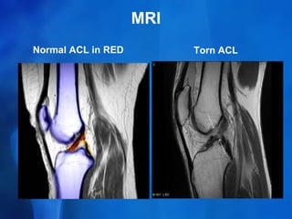 knee-anatomy.ppt