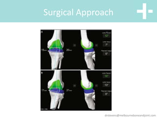 Common Knee Conditions and their management | PPTX