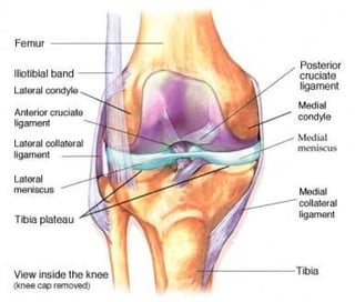 The difference between an ACL and MCL tear, and the rehab needed